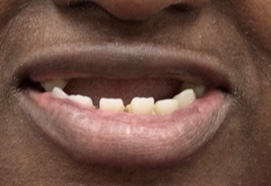 Pampered Smiles Dentistry